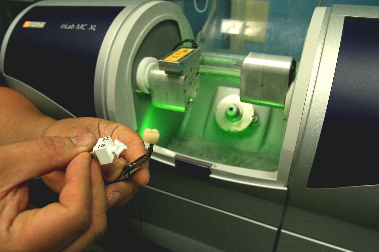 Couronnes en zircone avec cosmetique ceramique