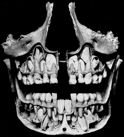 Dents de lait d'un enfant